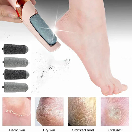 Electric Foot File Callus Remover Machine – Removes Dead Cells