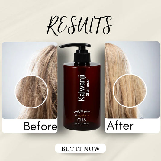 Organic Kalwanji Black Seed Shampoo 250ml – BUY 1 GET 1 FREE - MIP